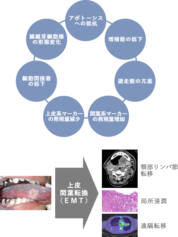 研究について - 当分野について│九州大学病院 顎口腔外科 口腔