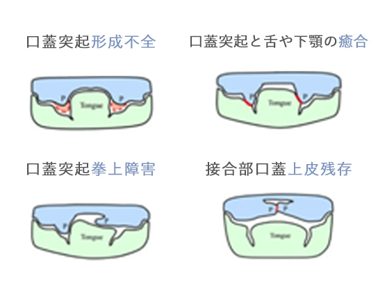 研究について - 当分野について│九州大学病院 顎口腔外科 口腔